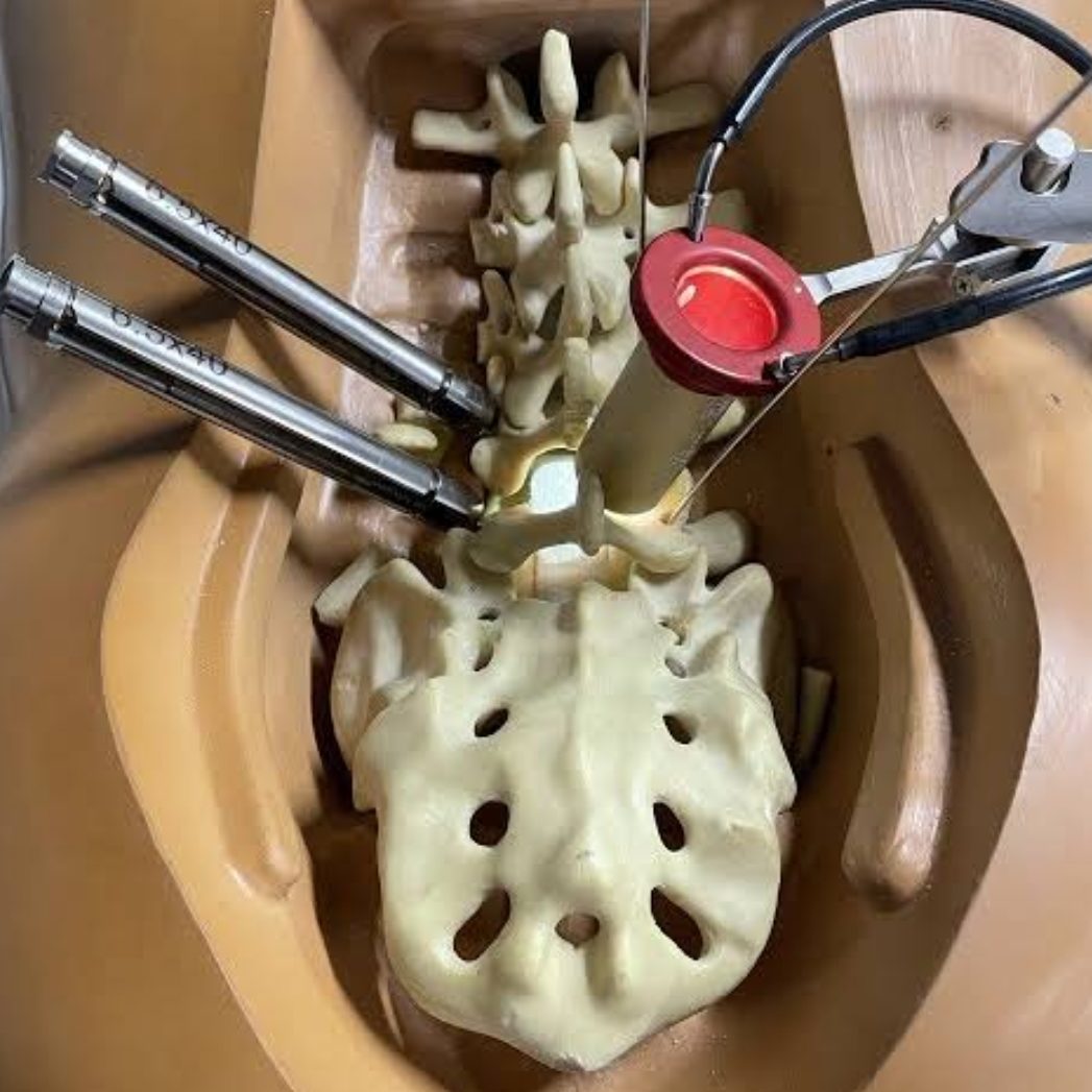 Spine surgery