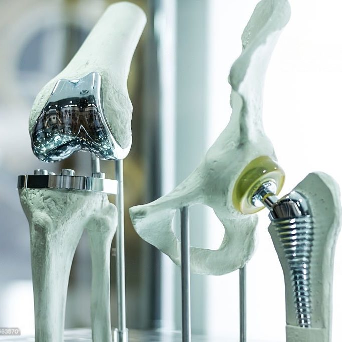 Prótesis de rodilla y cadera
